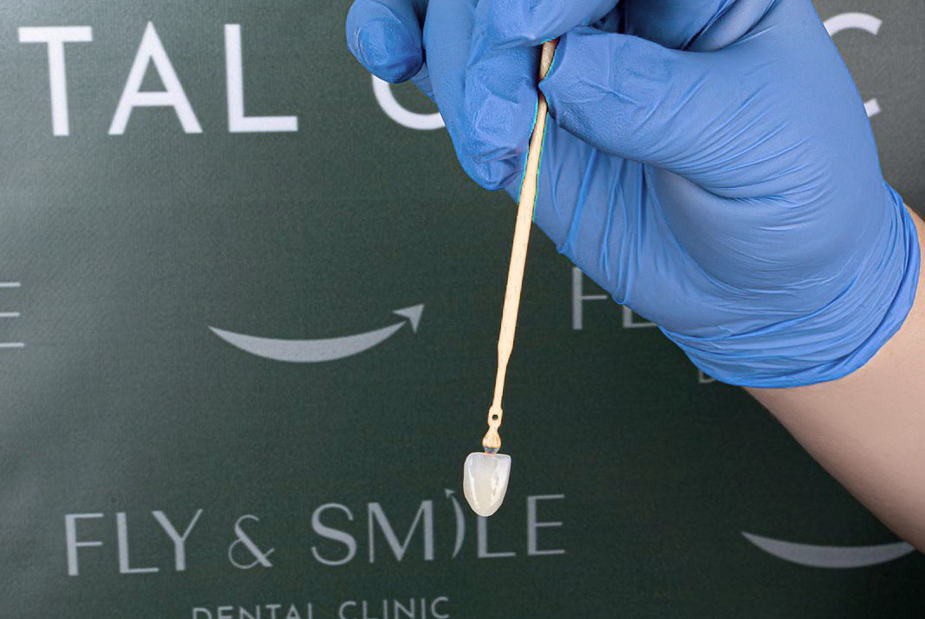 תכנון השתלה על גבי סריקת CBCT תלת-ממדית במסך חדר הטיפולים