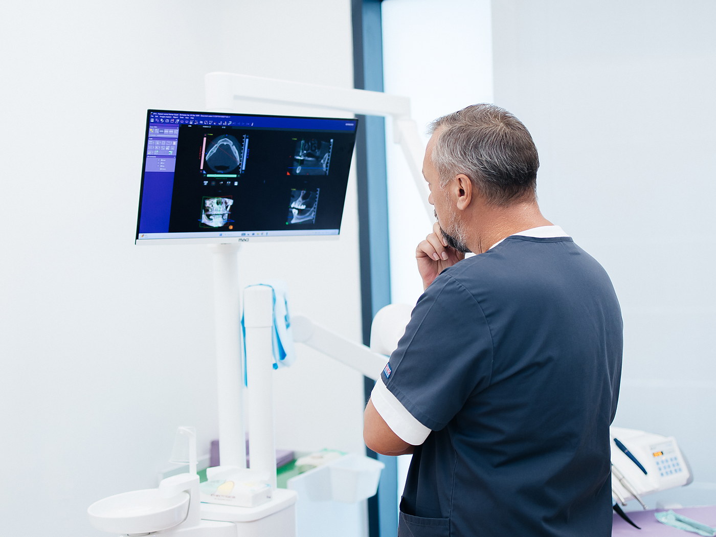 רופא של Fly & Smile בוחן סריקת CBCT על גבי מסך לפני תכנון הטיפול